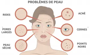 eau-micellaire-emploi