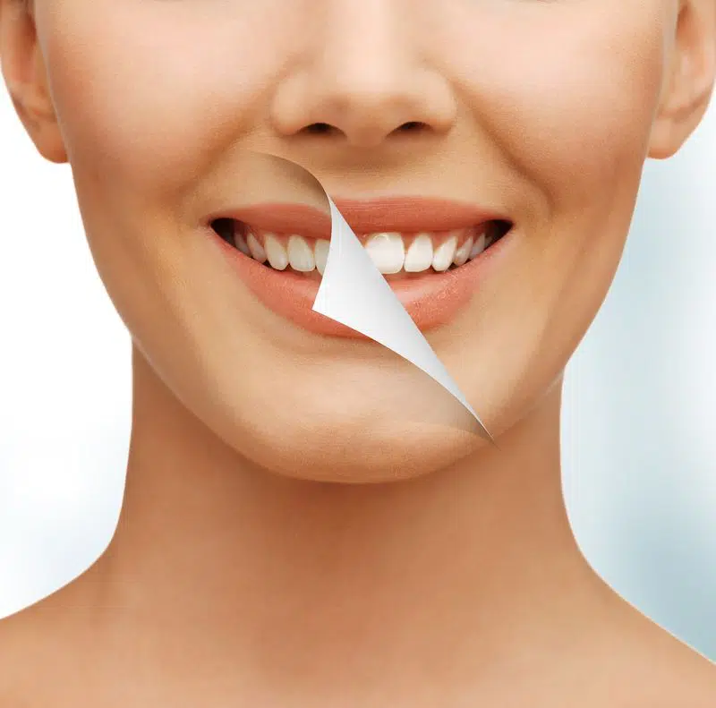 blanchir-dents-recette